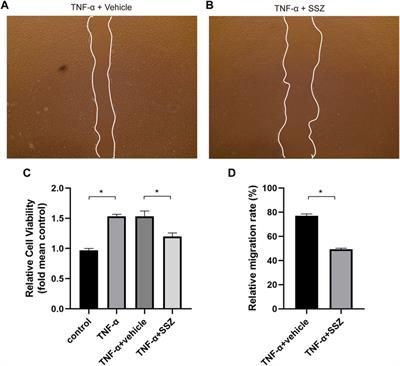 Sulfasalazine induces autophagy inhibiting neointimal hyperplasia following carotid artery injuries in mice